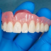 Blue-gloved hand holding a full upper arch of dentures