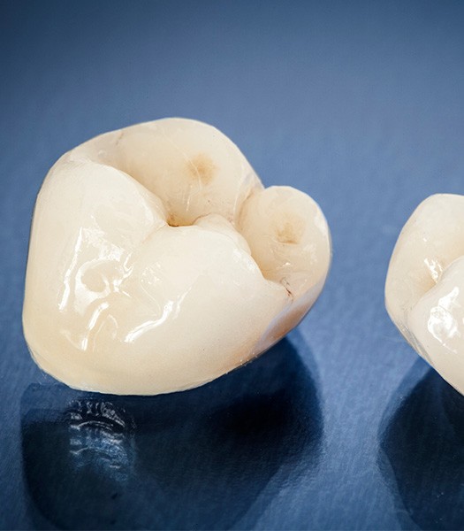 Two dental crowns resting on dark surface