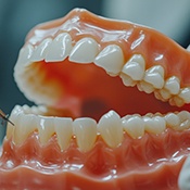 Dentures can be made of several different materials