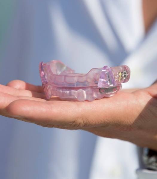Hand holding a sleep apnea therapy oral appliance