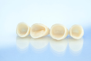 Four dental crowns in a row